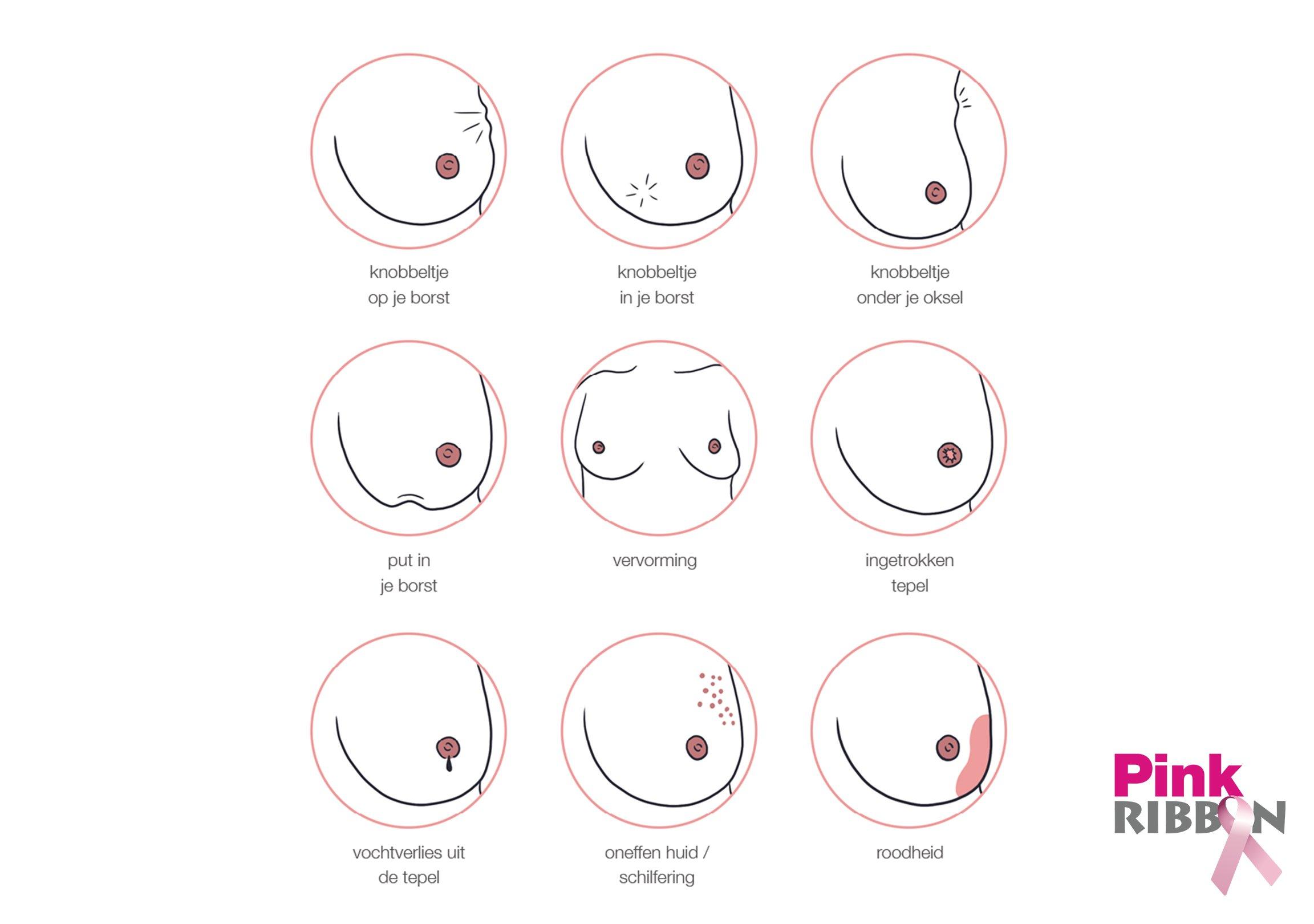 Pink26_CP_SupportContainer_AlarmSignals_NL