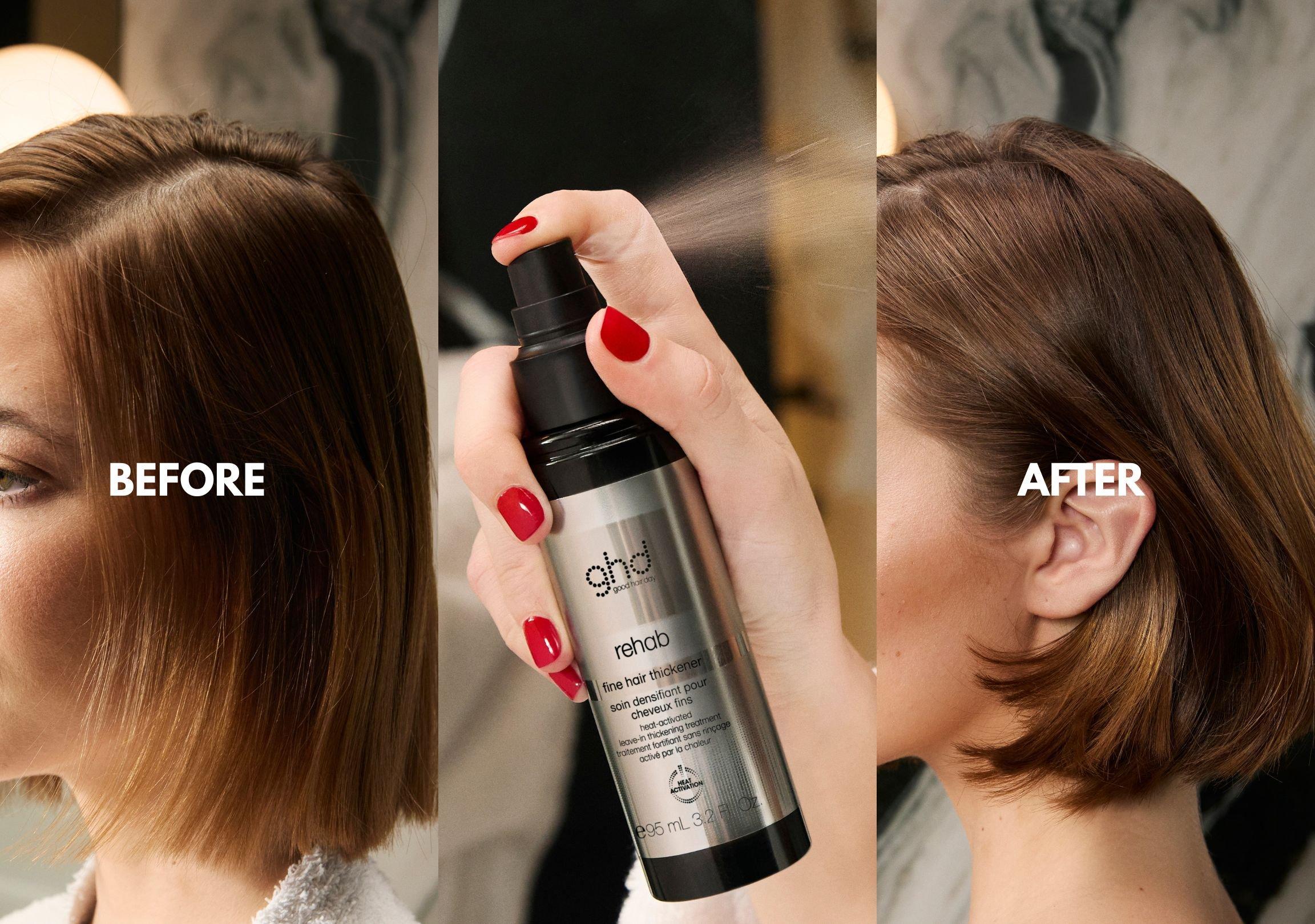 Rehab_FineHairThicker_BnA_SupportBanner_NZ